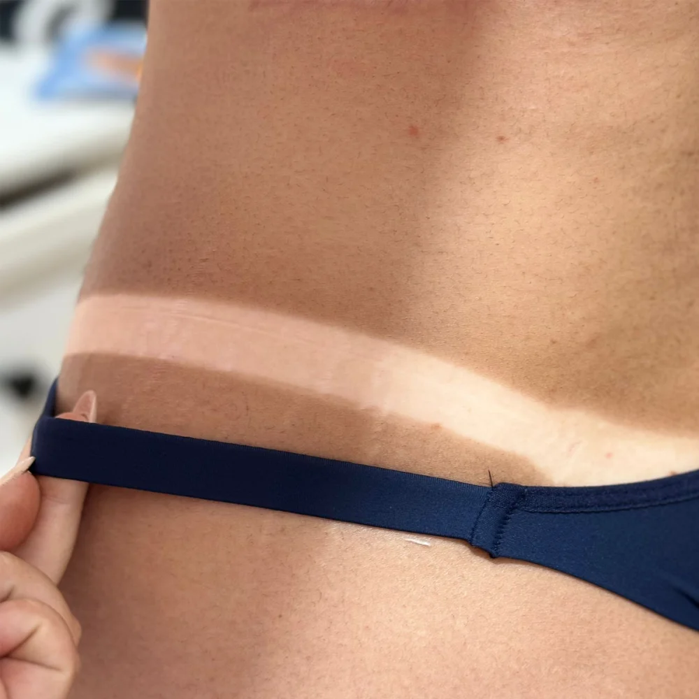 Detalhe de marcação de bronzeamento na cintura, Romana Bronze